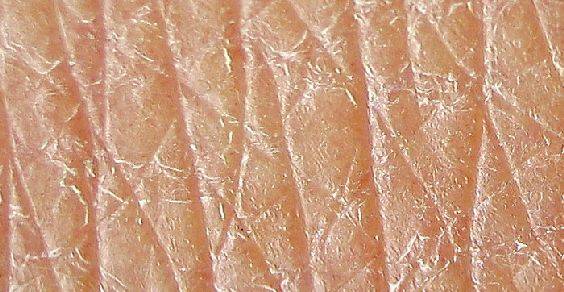 gordura subcutânea ajuda