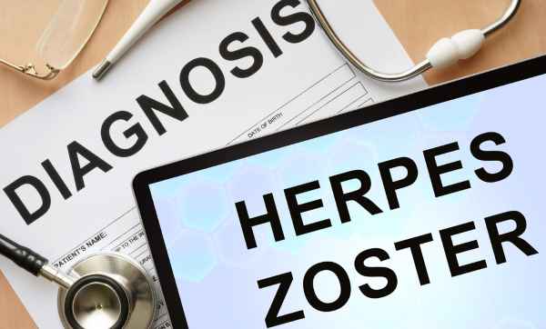 hrpes zoster 2