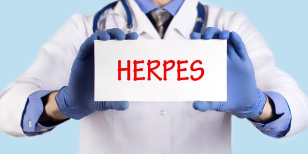 herpes