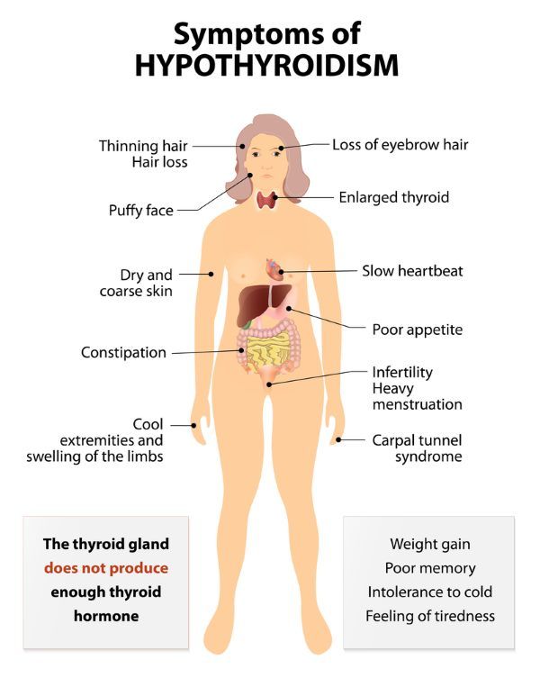 hipotireoidismo sintomas