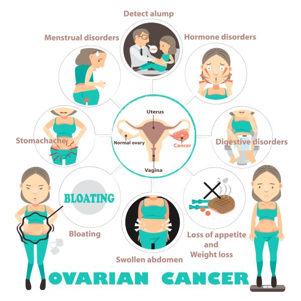 cancer ovarico