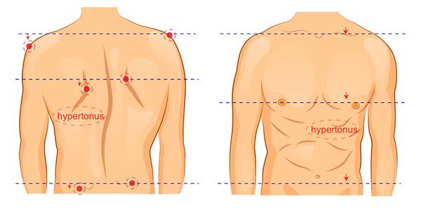 Escoliose Causas Sintomas E Como Intervir Com Exercicios