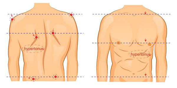 Escoliose Causas Sintomas E Como Intervir Com Exercicios