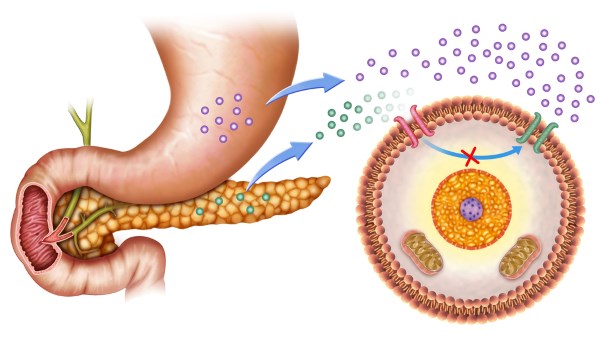 insulina 2