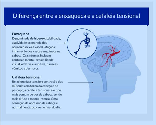 enxaqueca grafico