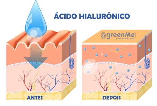 ácido hialurônico