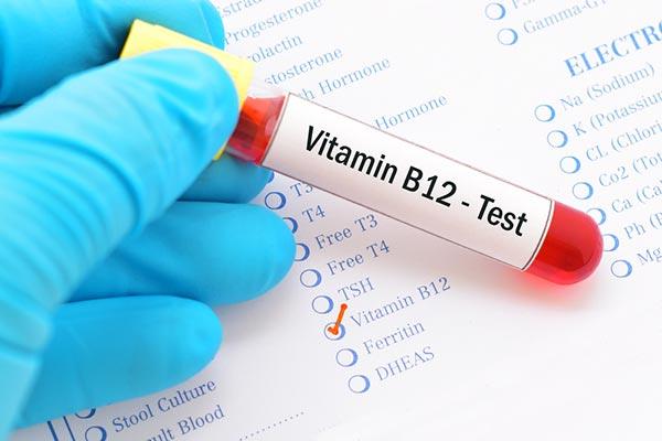 B12