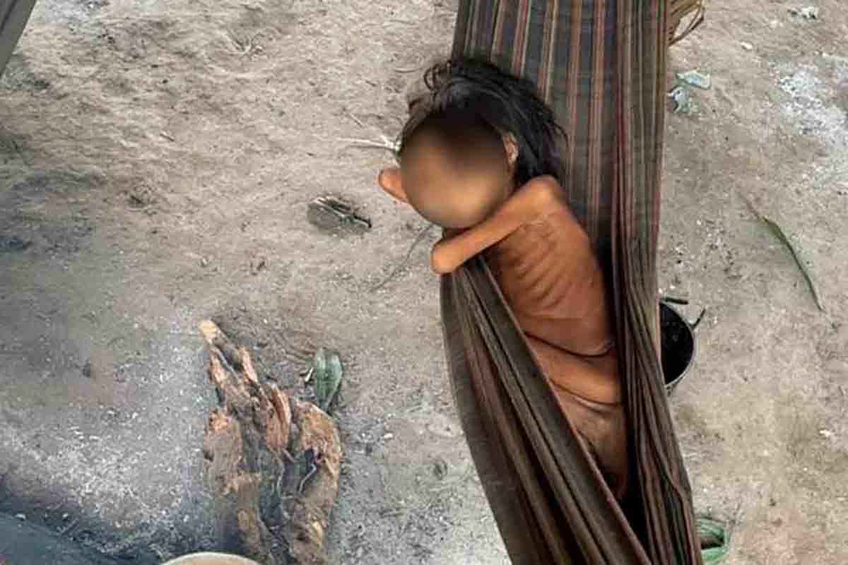 Além de Covid, casos de malária e verminose explodem entre os Yanomamis