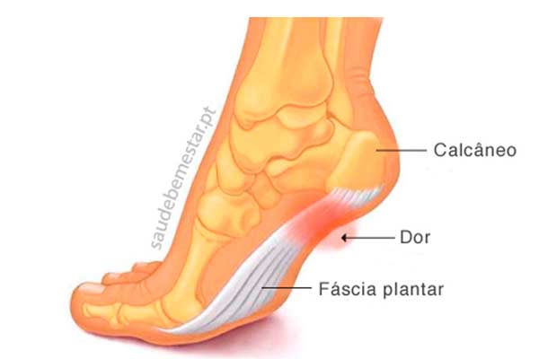 <em>                                      <a href="https://www.saudebemestar.pt/pt/clinica/ortopedia/fascite-plantar/">Saúde Bem-Estar.Pt</a></em>